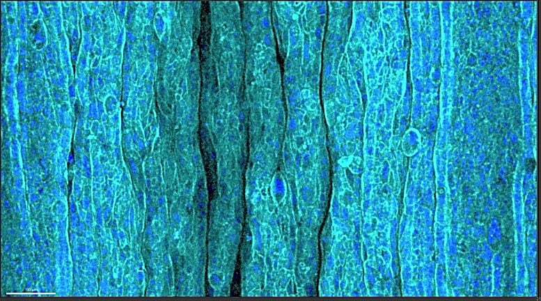 Wrinkled Epithelium Hydrogel