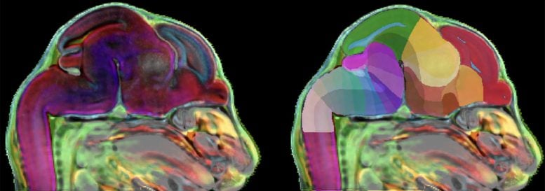 3D Atlas of the Developing Mouse Brain