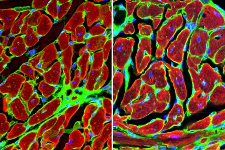 Heart Muscle Cells Surrounding Damaged Tissue