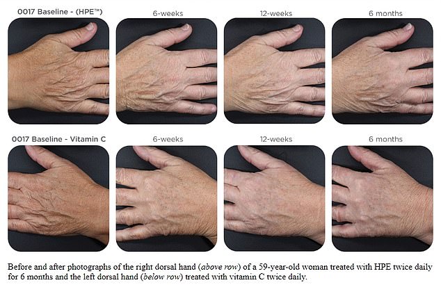 The images above show the hands of a 59-year-old volunteer - as above, she applied the high price serum to her right hand (top row) and the budget serum to her left (bottom row). The low-cost product was better at reducing common signs of aging, including age spots and wrinkles