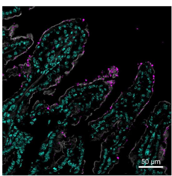 The Cryptosporidium parasite up close