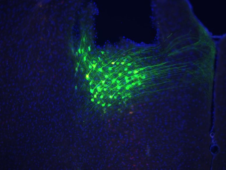 dACC Neurons in Mouse Brain