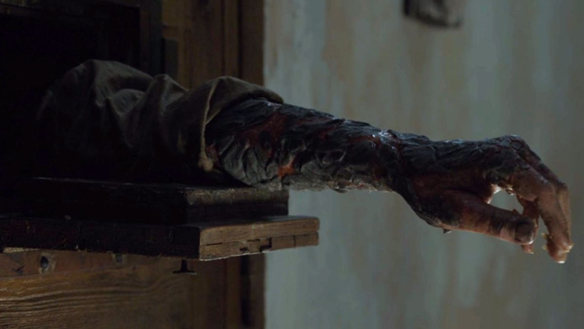 An arm with greyscale from Game of Thrones