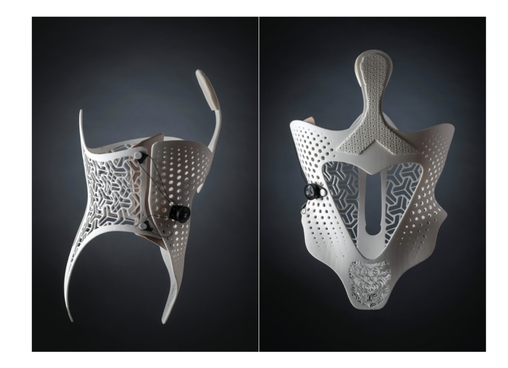 Sculpteo and Daniel Robert's 3D printed Orthosis. Images via Sculpteo.