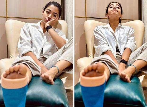 Rashmika Mandanna confirms about sustaining leg injury; pens note apologizing to filmmakers 