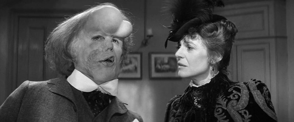 John Hurt and Anne Bancroft in The Elephant Man (1980)