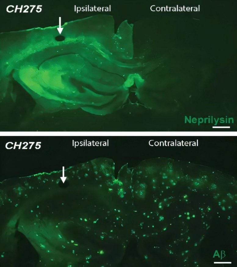 CH275 Effects on Neprilysin and Amyloid