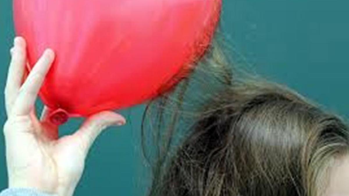 IMG_Hair_balloon_wikimed_2_1_SHCLHTKS.jpg