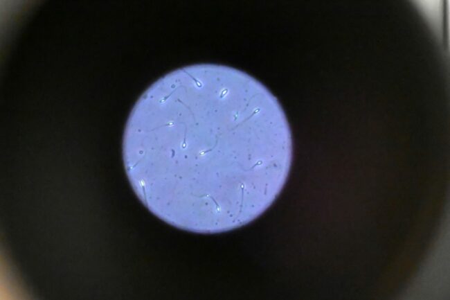 Sperm-cells-seen-through-a-microscope.jpeg