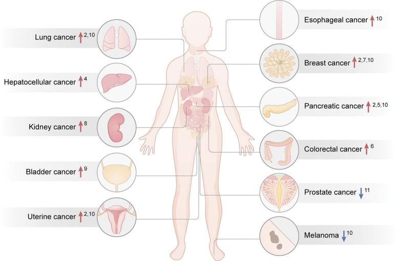Type 2 Diabetes and the Risks of Cancer Graphic