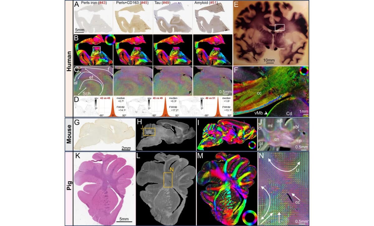 Comsli Detects Fiber Orientations Independent Of Tissue Preparation And Species