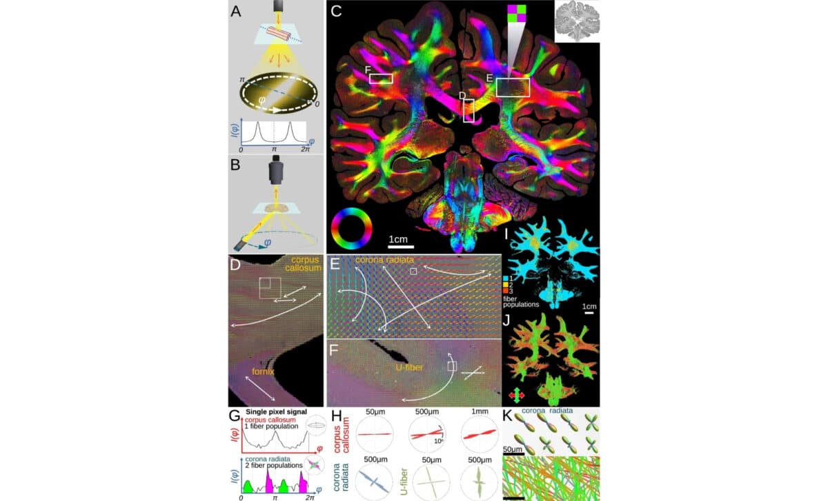 Retrieving Microscopic Fiber Orientations In A Whole Human Brain Section